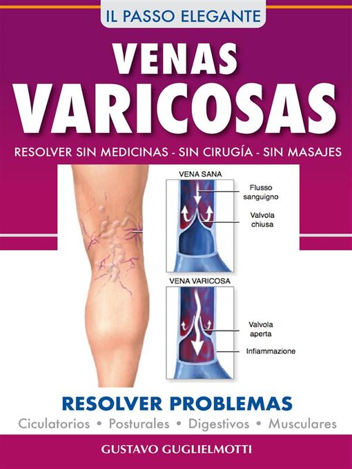 Title details for Venas Varicosas--Solución definitiva by Gustavo Guglielmotti - Available